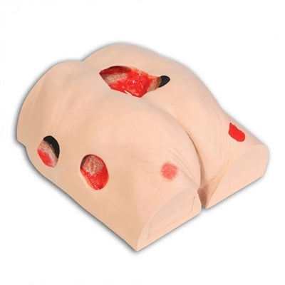 Seymour II Decubitus Wound Care Model (Wound Care Model/Accessories) - Img 1