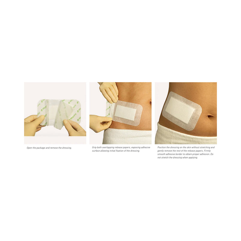 Mepore® Adhesive Dressing, 3-2/3 x 10 Inch, 1 Case of 210 (General Wound Care) - Img 5