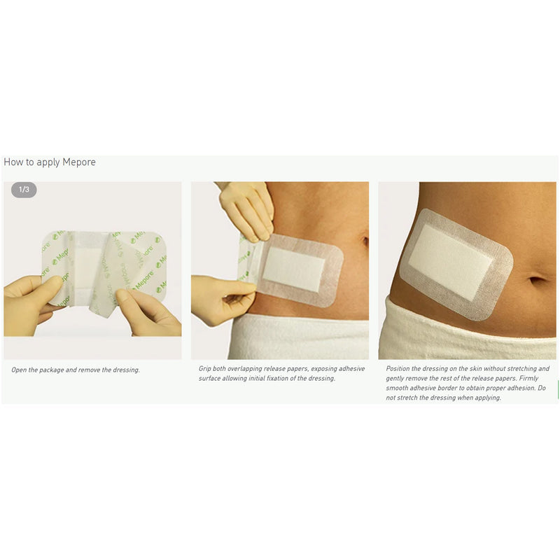 Mepore® Adhesive Dressing, 2½ x 3 Inch, 1 Case of 480 (General Wound Care) - Img 2