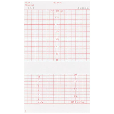 McKesson Fetal Monitoring Paper, 1 Case of 6400 (Diagnostic Recording Paper and Film) - Img 2