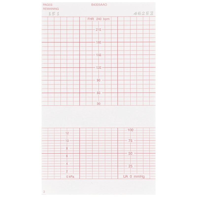 McKesson Fetal Monitoring Paper, 1 Case of 6400 (Diagnostic Recording Paper and Film) - Img 2