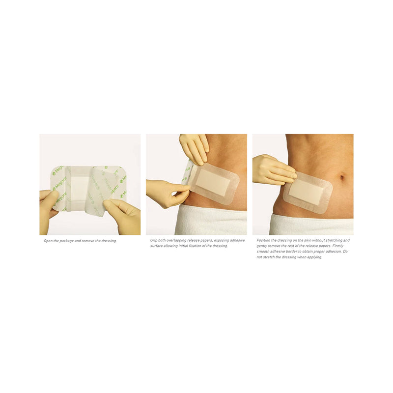 Mepore® Pro Absorbent Dressing, 3 x 8 inch, 1 Case of 180 (General Wound Care) - Img 4