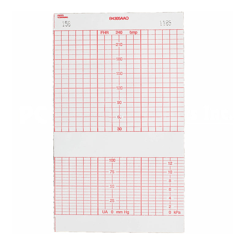 Life Trace® Fetal Monitor Recording Paper, 1 Roll (Diagnostic Recording Paper and Film) - Img 1