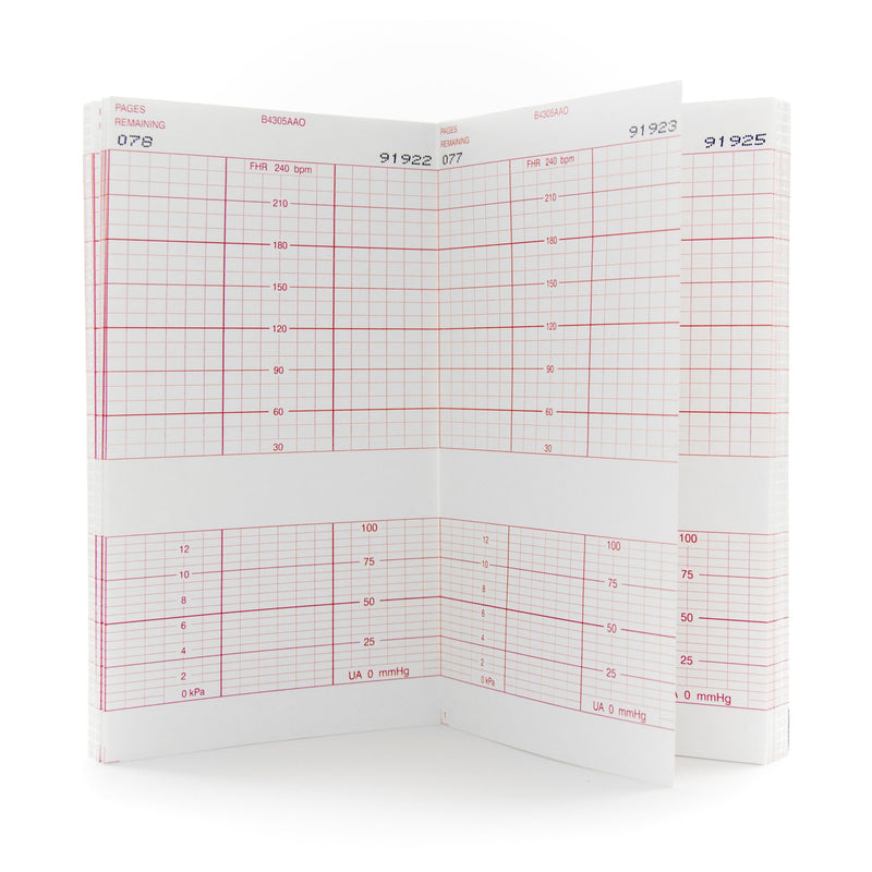 McKesson Fetal Monitoring Paper, 1 Case of 6400 (Diagnostic Recording Paper and Film) - Img 1