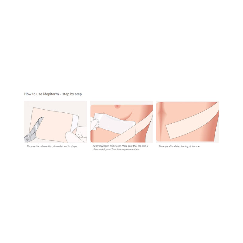 Mepiform® Self Adherent Silicone Dressing, 4 x 7 Inch, 1 Case of 35 (Advanced Wound Care) - Img 3