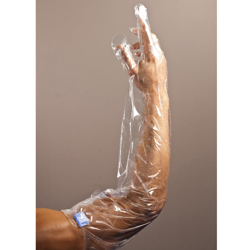 AquaGuard Glove® Wound Protector, 34 Inch, 1 Case of 75 (General Wound Care) - Img 2