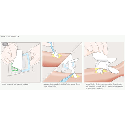 Mesalt® Sodium Chloride Impregnated Dressing, 8 x 8 Inch, 1 Each (Advanced Wound Care) - Img 2