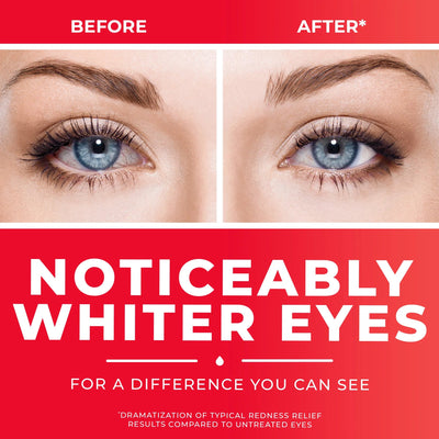 Clear Eyes® Allergy Eye Relief, 15 mL, 1 Each (Over the Counter) - Img 5