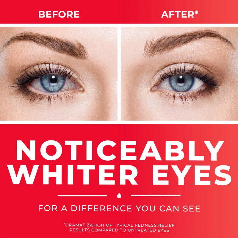 Clear Eyes® Allergy Eye Relief, 15 mL, 1 Each (Over the Counter) - Img 5