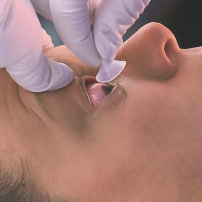 Morgan® Lens Eye Irrigation System, 1 Each (Wound Care Accessories) - Img 2