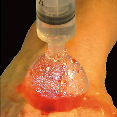 McKesson Quintet AC® Blood Glucose Monitoring System, 1 Each