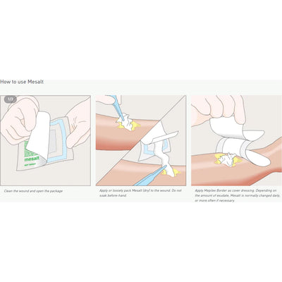 Mesalt® Sodium Chloride Impregnated Dressing, 6 x 6 inch, 1 Each (Advanced Wound Care) - Img 2