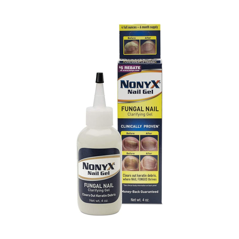 NonyX Ethanoic Acid Antifungal, 4 oz. Bottle, 1 Each (Over the Counter) - Img 1