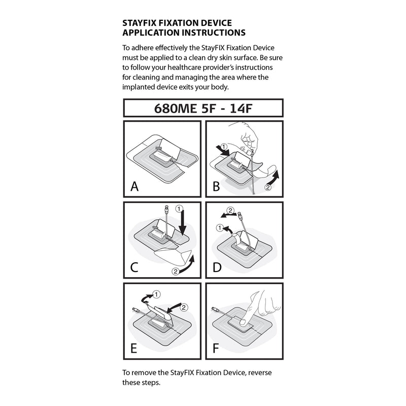 Stayfix® Catheter Fixation Device, Large, 1 Each (Urological Accessories) - Img 5