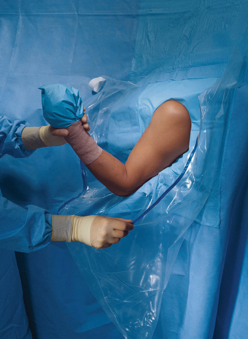 Halyard Sterile Shoulder Arthroscopy Orthopedic Drape, 160 W x 102 L Inch, 1 Case of 10 (Procedure Drapes and Sheets) - Img 1