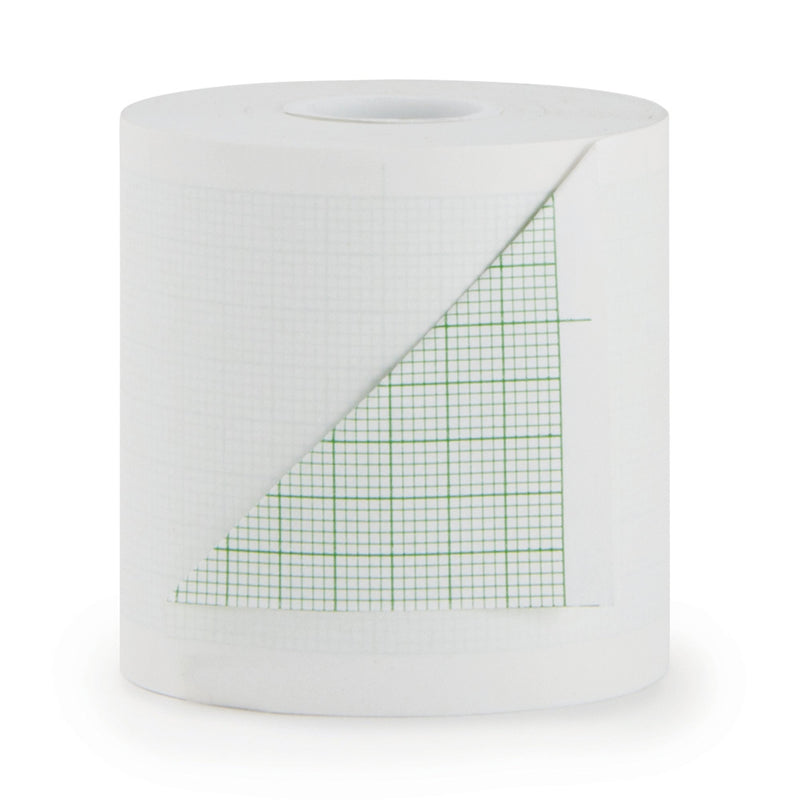 McKesson ECG Thermal Recording Paper, 1 Case of 60 (Diagnostic Recording Paper and Film) - Img 1